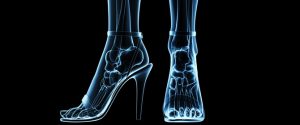 xray of feet in shoes