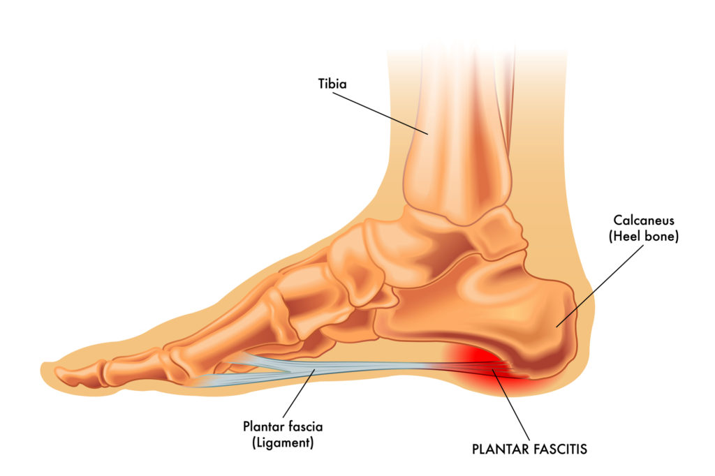 Plantar Fascia