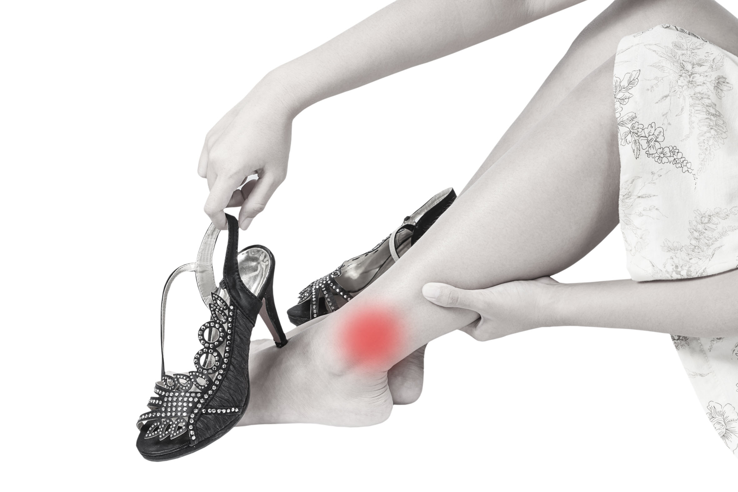 Heel Spurs: Treatment, Causes & Symptoms | The Feet People Podiatry